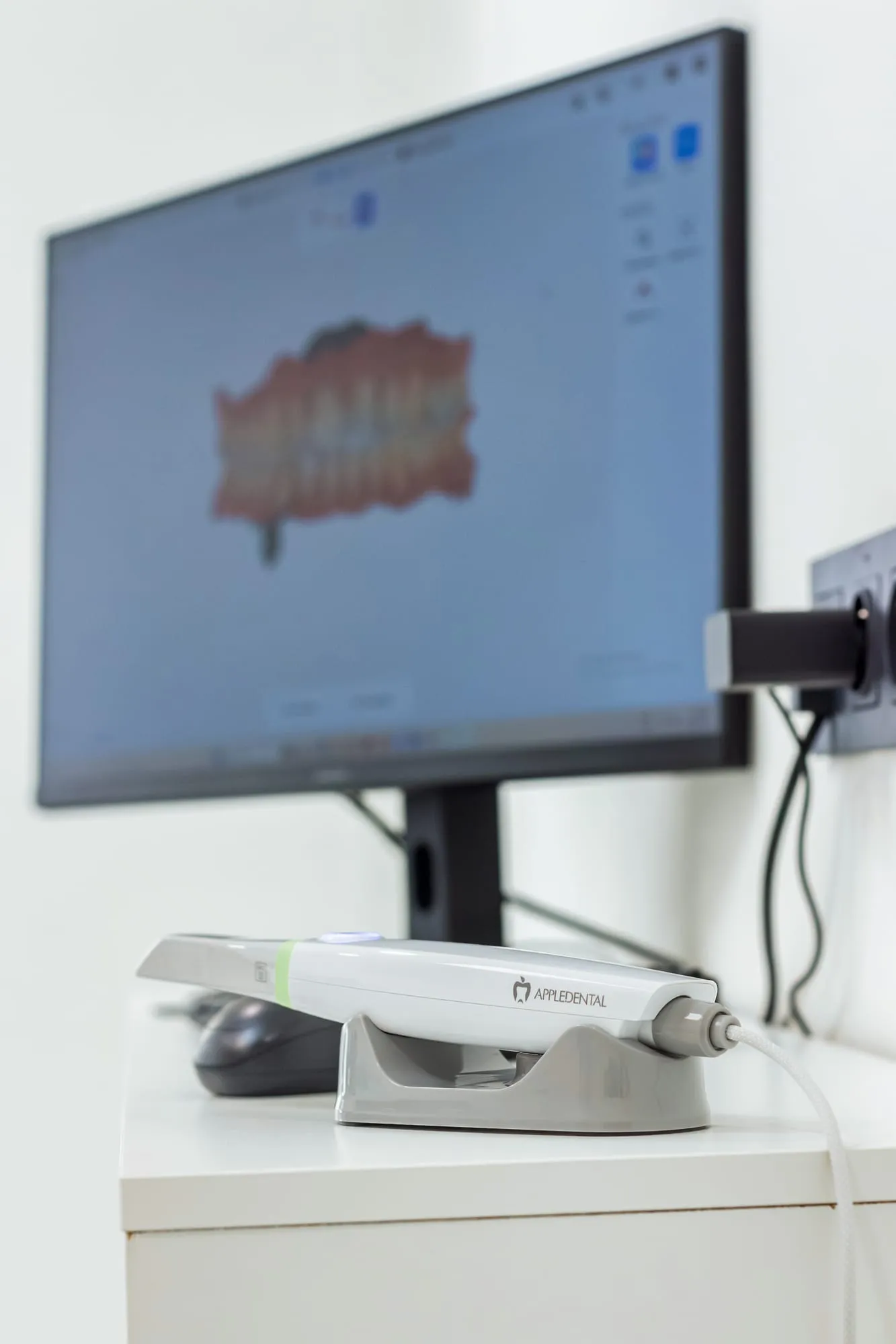 Scanner intra-oral posé sur son support, devant un écran affichant le modèle 3D d’une arcade dentaire